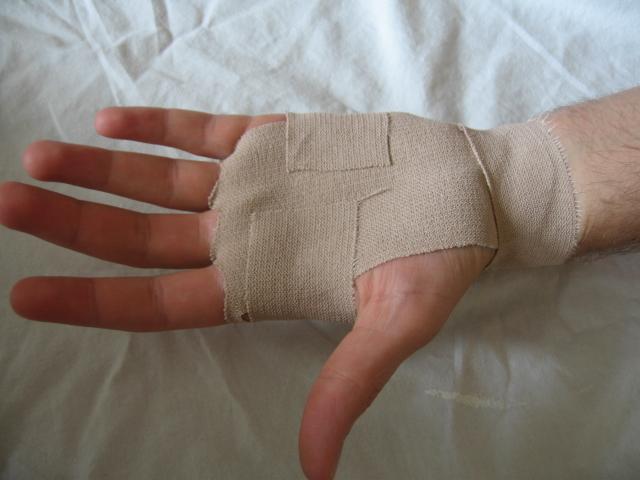 Vad gör du för att motverka blåsor i händerna? Lär dig tejpa av Magnus från kiropraktor.se