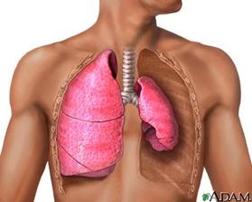 Punkterad lungsäck